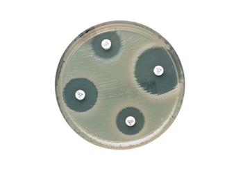 MICROBIOLOGY
